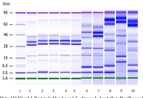 beatrice ana maria tudor tulcea|Use of microfluidic electrophoresis on chip in the analysis of milk .